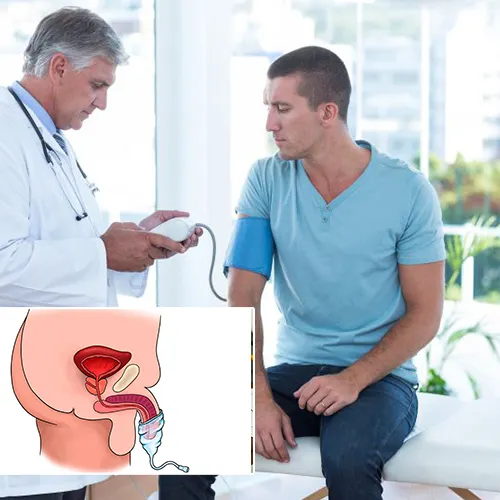 What to Expect When Seeking Coverage for Your Penile Implant