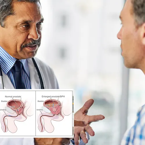 Welcome to Virtua Center for Surgery 
: Your Comprehensive Guide to Penile Implant Surgery FAQ