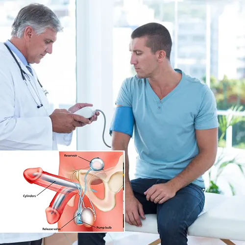 Expert Advice from [DOCTOR] on Advanced Care for Your Penile Implant