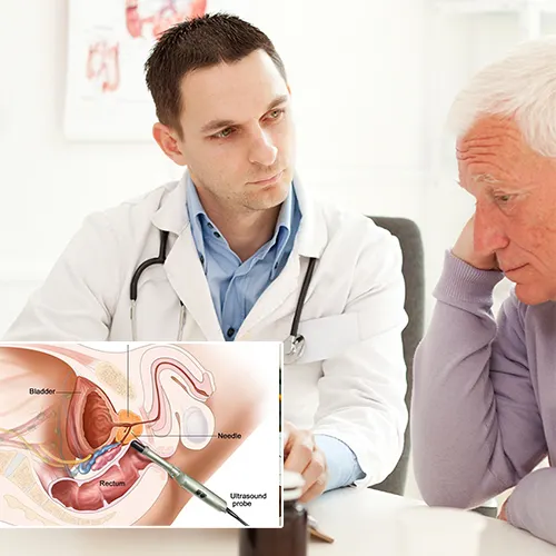 The Process of Penile Implant Surgery at Virtua Center for Surgery
